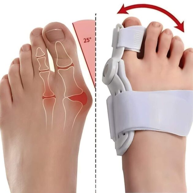 مصحح اعوجاج اصبع القدم